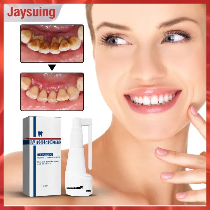 Jaysuing Calculus Dissolving Dental Spray Remove Bad Breath Lasting Fresh Natural Plant Safe
