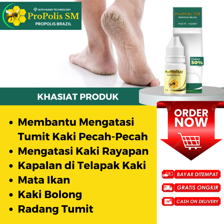 Obat Kaki Pecah-Pecah, Kaki Rayapan, Kaki Bolong-Bolong, Mata Ikan ...