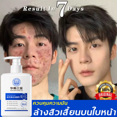 【ผิวขาวกระจ่างใส】Lanning โฟมล้างหน้า 220g ให้ความชุ่มชื้น ควบคุมความมันและสิว ไวท์เทนนิ่ง+ฟื้นคืนผิวให้อ่อนเยาว์（ โฟมล้างหน้าสำหรับผู้ชาย เนื้อครีมสครับ โฟมล้างหน้า น้ำนมล้างหน้า เจลล้างหน้า คลีนเซอร์ ฟอมล้างหน้า โฟมล้างหน้าผู้ชาย）