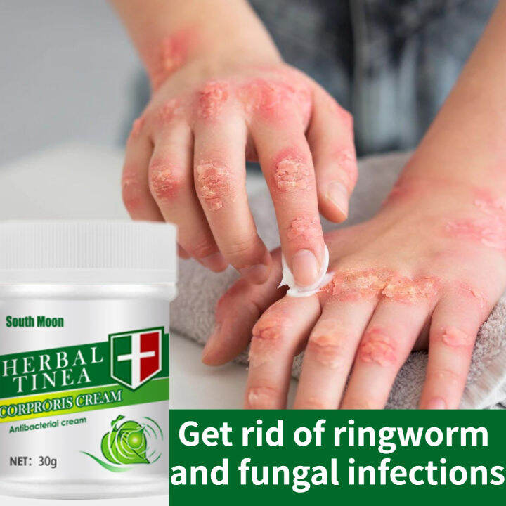 Herbal Topical Antibacterial Cream Quickly Remove Ringworm Quickly