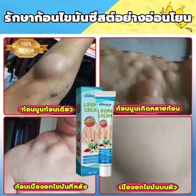 แท้ South Moon ออกแบบ36ชนิดของไขมันใต้ผิวหนังกำจัดมวลก้อนไปยังถุงน้ำ Lymph Care Ointment สมุนไพรกำจัด ก้อนเนื้อใต้ผิวห