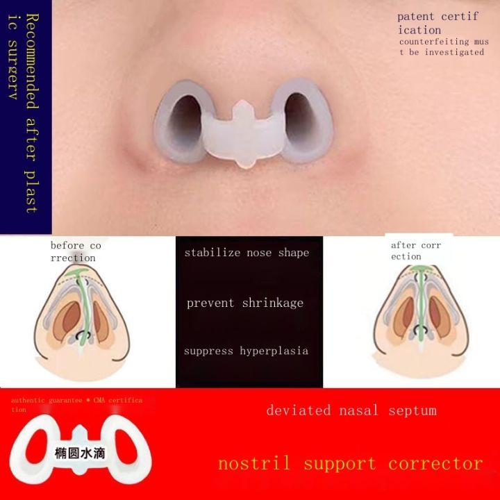 Comprehensive edges postoperative nasal shape support nostril nose ...