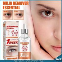 South Moon Milia Remover Essential Oil Eyes Fat Granules Removal Serum Anti-Aging Moisturizing Anti-Puffiness Whitening Eye Skin Care (30ml）