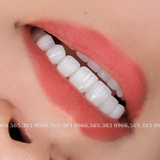 Làm răng sứ thẩm mỹ lava plus giảm còn 3,5 triệu một răng - ảnh sản phẩm 1