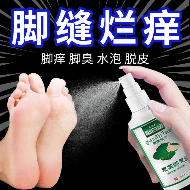 [Athlete's foot odor and itching] Itching peeling blisters erosion