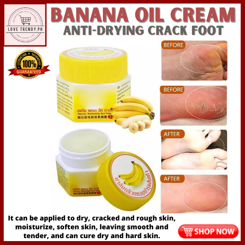 Foot Peeling Foot Cracked Heel Repair Moisturizes & Moisturizing Callus ...