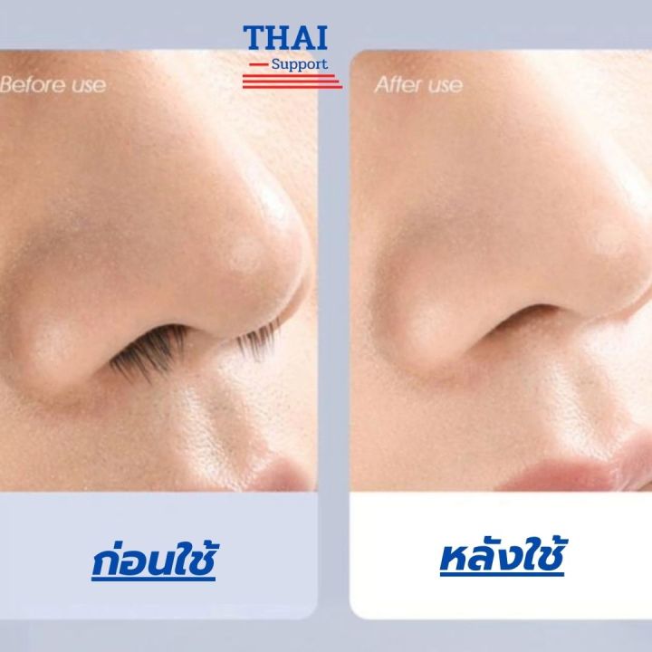 thai-support-ที่ตัดขนจมูก-เครื่องตัดขนจมูก-มีการรับประกันจากผู้ขาย-เครื่องตัดขนจมูกไฟฟ้า-ใช้ตัดขนจมูก-ออกแบบให้เข้าโพรงจมูกได้ง่าย-ไม่บาดจมูก-ตัดง่าย-ไม่หนีบขน-และประหยัดเวลา