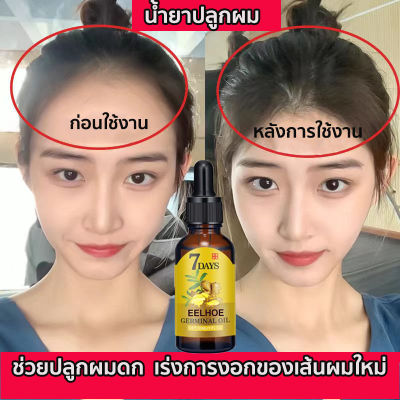 【ได้ผลดีมาก】หมดปัญหาผมร่วง EELHOE น้ำยาปลูกผม 40ml เร่งการงอกใหม่ ป้องกันไม่ให้ขิงหลุด รากผมแข็งแรง ดูแลหนังศีรษะ ​ยาปลูกผมของแท้ เซรั่มบำรุงผม เซรั่มปลูกผม น้ำยาเร่งผมยาว ซรั่มปลูกผม ยาปลูกผมผู้ชาย