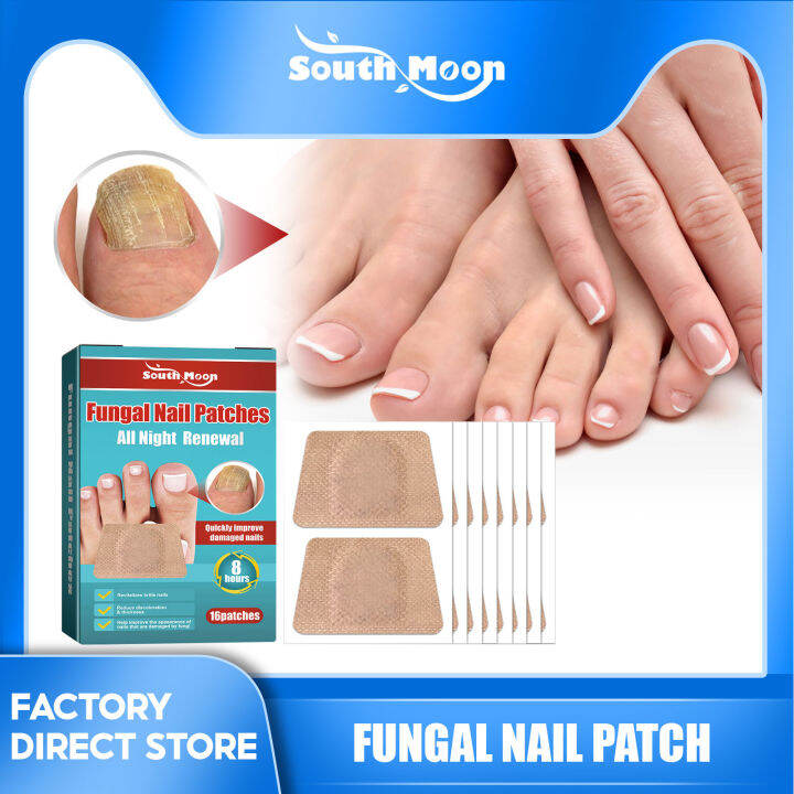 South Moon Fungal Nail Patches Ingrown Toenail Corrector Stickers
