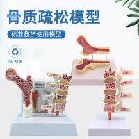 Human femoral bone lesions lumbar leg bone anatomical dissection model surface plane spine specimen