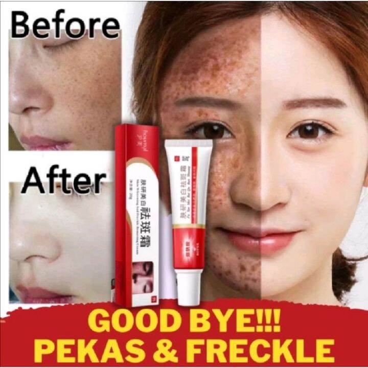 Melasma Face Cream Pekas Remover Collagen Whitening Spot Original Pekas