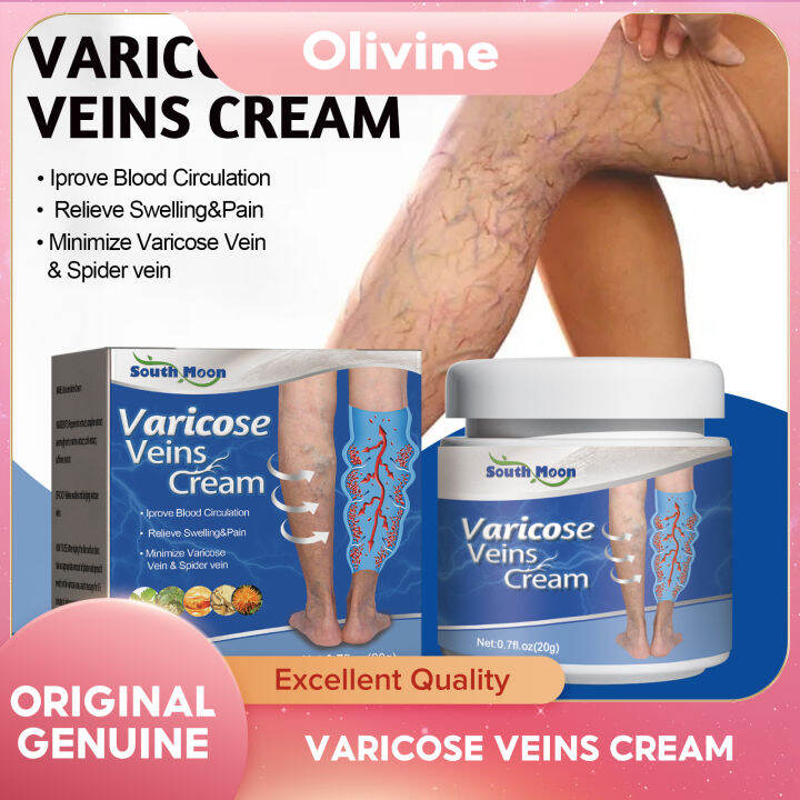 South Moon Effective Varicose Veins Cream Relieve Vasculitis Phlebitis