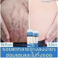 GUANJING ครีมทาท้องลาย ผิวแตกลาย80g?แก้ท้องลาย ลดรอยแตกลาย ขาแตกลาย สะโพกลาย ผิวลาย รอยแตกลาย**ของแท้ พร้อมส่ง