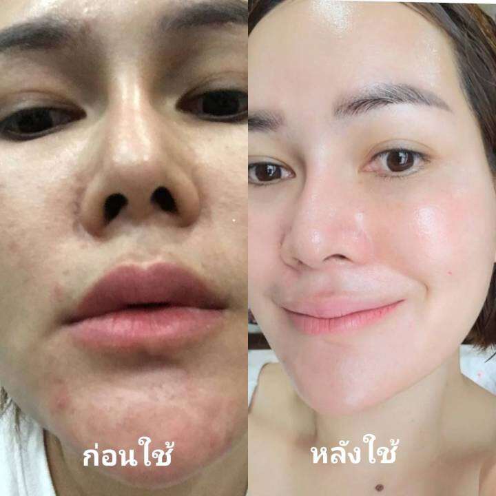 psc-สบู่หน้าเงา-aura-soap-1ก้อน-ขนาด-70g-princess-skin-care