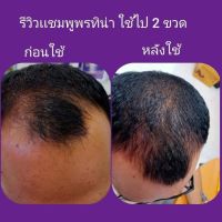 150 บ.มี COD แชมพูปลูกผม 1ขวด แถมครีมนวดผม1ซอง สูตรสมุนไพร ช่วยลดผมร่วง ผมบาง หัวล้าน ช่วยรักษารังแค อาการคันหนังศีรษะ 100ml