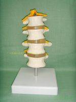 Four human lumbar combination model lumbar vertebral spine model lumbar intervertebral disc model