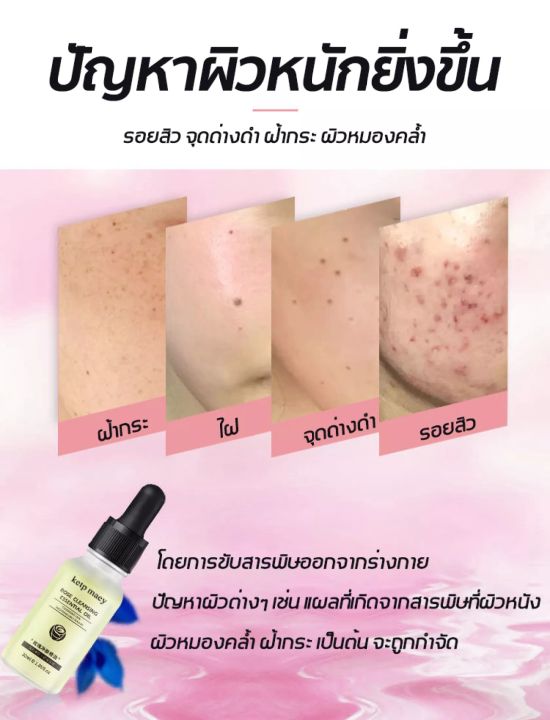 ketpmaey-ครีมทาฝ้า-30ml-ลดฝ้ากระที่ฝังลึก-กำจัดฝ้า-จุดด่างดำ-ฝ้า-กระ-กระจ่างใสผิว-ลดเม็ดสีเมลานิน-ครีมทาฝ้าลึก-ครีมหน้าขาวใส-ครีมทาฝ้ากระ-ครีมฝ้ากระ-ครีมทาหน้าขาว-ครีมกระไวท์เทนนิ่ง-ไวท์เทนนิ่งครีม-คร