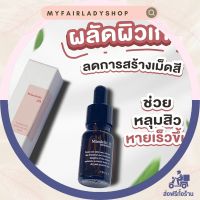 Mandelic Acid 30% ช่วยรอยสิวกับหลุมสิว