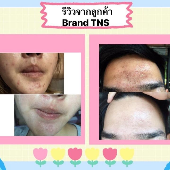 อัลฟ่า-อาร์บูติน-ครีม-alpha-arbutin-cream-by-brand-tns