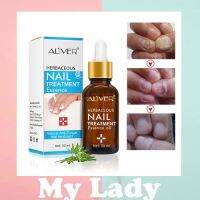 Mylady Aliver Herbaceous Nail Treatment Essence 30ml. วิตามินบำรุงเล็บ ฟื้นฟูสุขภาพเล็บ Nail Repair Essence เซรั่มบำรุงเล็บ ป้องกันเชื้อรา แก้ไขปัญหาเล็บต่างๆ