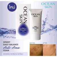 Ocean Skin Speedy daily balance 2สูตร Anti acne/ลดสิว และ Whitening/ขาวใส ขนาด 50ml.