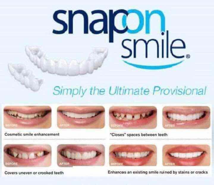 The Original Snap On Smile Teeth One Size Fits Snapon Snapon Smile