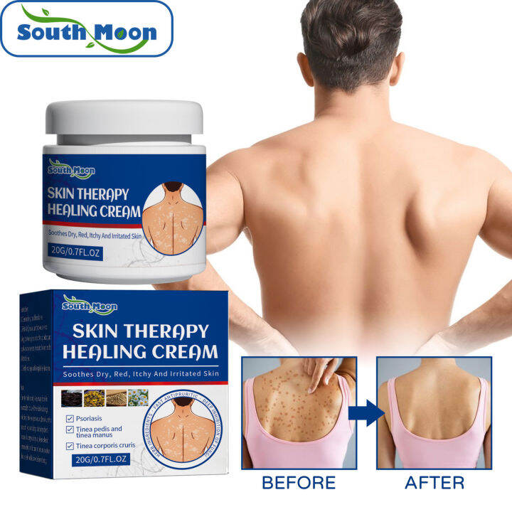 South Moon Fat Lump Repair And Soothing Body Care Cream For Fat Lumps