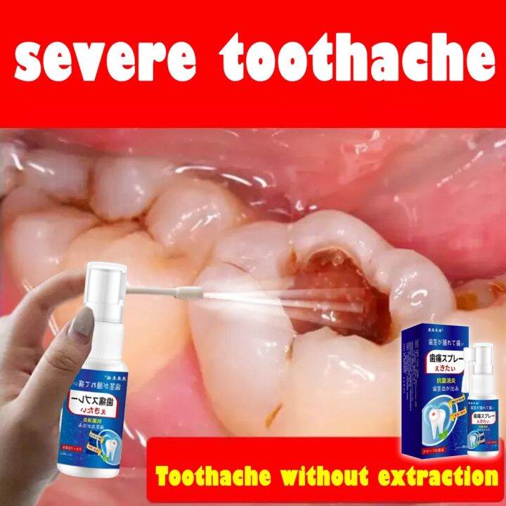 20ml Japan Toothache Spray Pain Relief Plant Extracts toothache spray