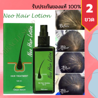 Neo Hair Lotion 120ml นีโอแฮร์โลชั่น neohair นีโอแฮร์ นีโอแฮร์ของแท้ ยาปลูกผมผู้ชาย ยาปลูกผมหญิง นีโอ แฮร์ สเปรย์ปลูกผม เซรั่มปลูกผม ปลูกผม ผมร่วง