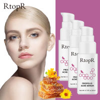 RtopR 3PCS FDA ชิ้นราคาถูก สาระสำคัญสิว กำจัด สิวในวัยรุ่น สิวอุดตัน กำจัดสิว แผลเป็น  รูขุมขนหดตัว รักษาผิวหนังPropolis Repair Acne Brightening Serum