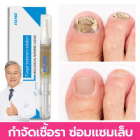 เซรั่มซ่อมแซมเล็บ Nail Repair Serum เซรั่มบำรุงเล็บ ฆ่าเชื้อราเล็บ บำรุงเล็บเสีย บำรุงเล็บ (ครีมบำรุงเล็บ เซรั่มรักษาเล็บ เอ็สเซ้นซ่อมแซมเล็บเสีย เชื้อราเล็บมือ ครีมบำรุงเล็บ เชื้อราที่เล็บ เล็บเป็นเชื้อรา ยาแก้เชื้อราในเล็บ เซรั่มเล็บขบ ยาหยอดเล็บ）