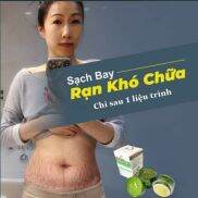 multi 16 không lo về rạn