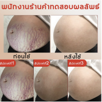 GUANJING ครีมทาท้องลาย ผิวแตกลาย80g?แก้ท้องลาย ลดรอยแตกลาย ขาแตกลาย สะโพกลาย ผิวลาย รอยแตกลาย**ของแท้ พร้อมส่ง