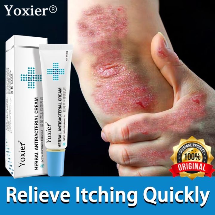 Yoxier herbal antibacterial cream Eczema Ointment Psoriasis Cream Anti ...