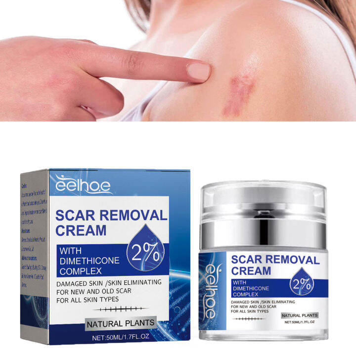 Scar Repair Cream for old scar on leg stretch mark remover acne scar ...