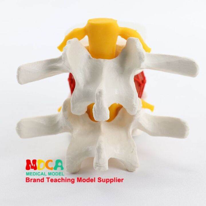 lumbar-disc-medical-massage-lumbar-spine-model-demonstration-model-equipment-medical-teaching