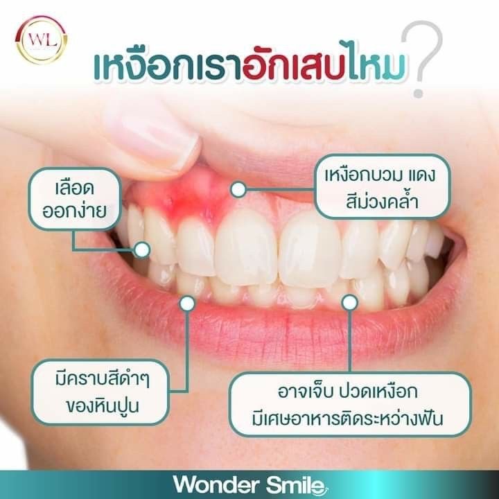 ยาสีฟัน-wonder-smile-วันเดอร์สไมล์-1-แถม-1-ยิ้มสวย-อย่างมั่นใจ-1-หลอด-ขนาด-80-กรัม