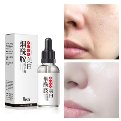 TOPQSC Nicotinamide Whitening Freckle Facial Serum Brightening Moisturizing Hydrating Lifting Firming Repairing Oil Control Shrink Pores Anti Aging Anti Wrinkle Face Essence Skin Care 30Ml