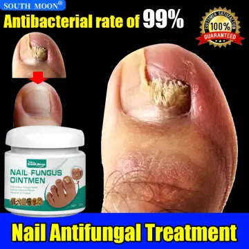 Natural Vine Toenail Fungus Treatment, Nail Fungus Treatment for Toenail,  Toe Nail Fungus Treatment Extra Strength, Fungus Nail Treatment, Na