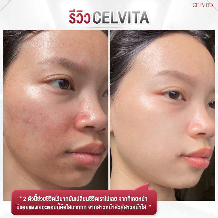 celvita-advanced-repair-serum-15g-telo-hya-x50-เซรั่มคุณหมอ-จุดด่างดำ-ผิวขาวกระจ่างใส-ลดเลือนริ้วรอย