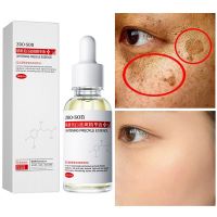 ใส่ใน Dark Skin Whitening freckle Facial Serum Dark Spot Corrector ที่มีประสิทธิภาพลบ melasma เมลานิน Dark spots pigment