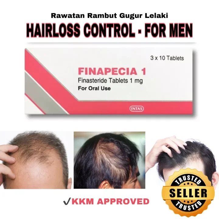 Hair Loss Treatment, FINAPECIA 1mg 30 Tablets (1month supply), KKM APPROVED  | Lazada