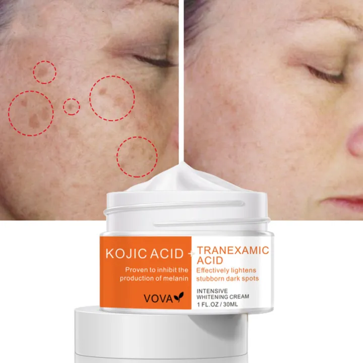 Kojic Acid Tranexamic Acid Dark Spot Corrector Cream Whitening Freckle ...