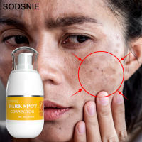 Dark Spot Corrector Moisturizing ช่วยขจัดจุดด่างดำ Chloasma Age Spots Sun Spots Whitening Brightening Facial Cream ได้อย่างมีประสิทธิภาพ