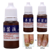 ?jiajia01? 10ml Health Skin Care NAIL Repair Treatment Liquid Cleanser Onychomycosis Remove