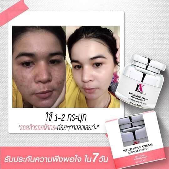 ไวท์เทนนิ่ง-lx-บำรุงให้กระจ่างใส-ใช้ได้ทุกสภาพผิว-1-กระปุก-ราคา-750