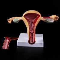 SEL♀ Human Pathological Uterus Ovary Model Anatomical Anatomy D