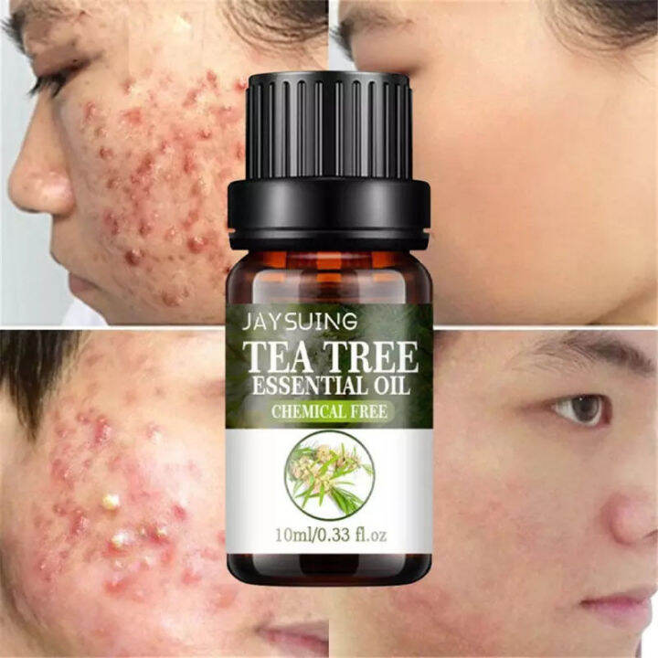 Tea Tree Essential Oil Serum For Face Glass Skin Reduce Acne Serum For
