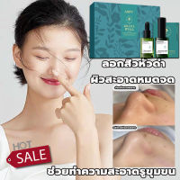 AOPY สูตรอ่อนโยน กำจัดสิวหัวดำ 3 in 1 Set ลบสิวหัวดำและสิว บำรุงกระชับรูขุมขน ขจัดผิวที่ตายแล้ว ผิวกระจ่างใส ครีมลอกสิวเสี้ยน ลอกสิวหัวดำ สิวอุดตัน ลอกได้ทั้งหน้า สูตรใหม่ สำหรับคนเป็นสิว และผิวแพ้ง่าย ( ที่ลอกสิวเสี้ยน ลอกสิวเสี้ยน มาร์คหน้าสิวเสี้ยน)