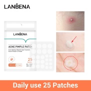 LANBENA 25 Miếng dán mụn dùng hàng ngày giúp điều mụn ẩn và vết thâm - INTL